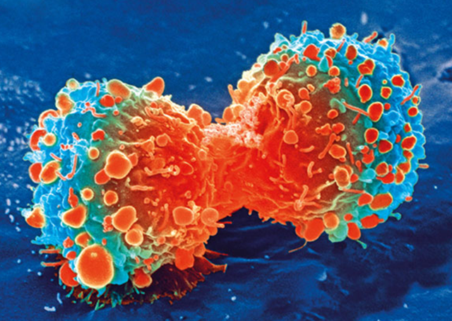 estudios marcador tumoral sustancia por cancer